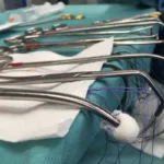 El proyecto plantea además un régimen sancionatorio para los profesionales que realicen, ordenen o ejecuten las intervenciones prohibidas. Según la información divulgada sobre la iniciativa, estas conductas podrían ser consideradas faltas graves contra la ética médica y dar lugar a sanciones, incluida la suspensión del ejercicio profesional en determinados casos - Foto: Enrique García Cruz