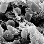 La peste neumónica es una forma de peste causada por la bacteria Yersinia pestis que afecta los pulmones. Puede transmitirse entre personas mediante gotículas respiratorias, especialmente durante el contacto cercano con una persona infectada que presenta síntomas - Foto: NIH