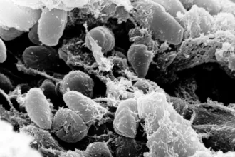La peste neumónica es una forma de peste causada por la bacteria Yersinia pestis que afecta los pulmones. Puede transmitirse entre personas mediante gotículas respiratorias, especialmente durante el contacto cercano con una persona infectada que presenta síntomas - Foto: NIH
